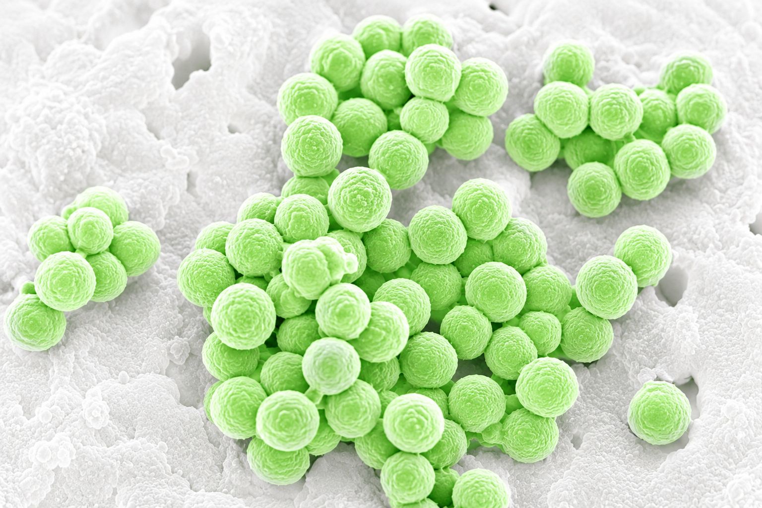 Coloured scanning electron micrograph of Staphylococcus aureus (MRSA) cell clusters